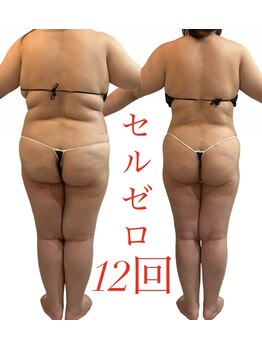 リノア(Lino'aka)/30代　○○さんの変化　痩ボディ