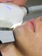 リベラリンク(Libera Link)の写真/【速攻ツルすべ肌へ】高出力パワーで顔の産毛も逃さない！抜けの早さにこだわった最新鋭顔脱毛で清潔感UP☆