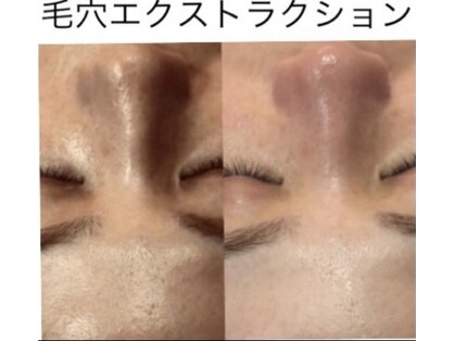 トータルエステ ユキ(YUKI)の写真