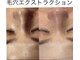 トータルエステ ユキ(YUKI)の写真