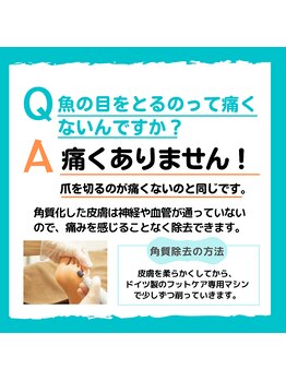 ポドウオーク(PODO WALK)/魚の目をとるのってどう？