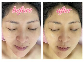 ノゾミジュク(希美熟 NOZOMIJUKU)/3倍美肌小顔