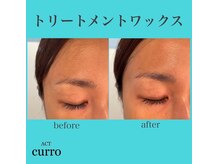 アクト クロ(ACT curro)/【フェイシャル】施術例