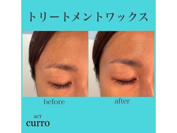 アクト クロ(ACT curro)/【フェイシャル】施術例