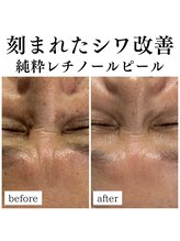 フェリス(FELIZ)/年齢に負けないお肌へ