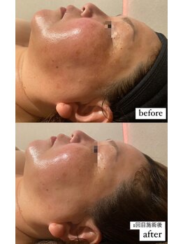 ディサイドロー(DECIDE L.A.W)/細胞から変えていくエステ