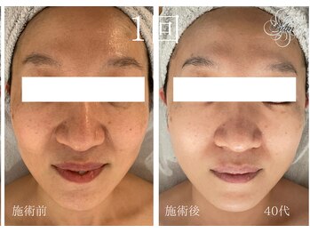 パーム(Palm)/クレンジングと洗顔だけで透明感