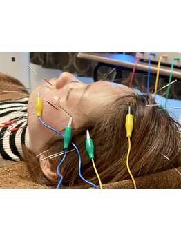 小顔になりたい