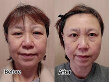 ネイルアンドアイラッシュ アヴィ(Nail and Eyelash A'vi)/エニシーグローパックプレシャス