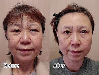 ネイルアンドアイラッシュ アヴィ(Nail and Eyelash A'vi)/エニシーグローパックプレシャス