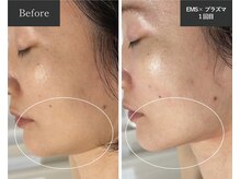 メロー(MELLOW)/プラズマスター