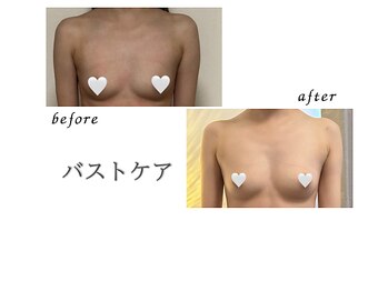 リリー(Lily)/バスト