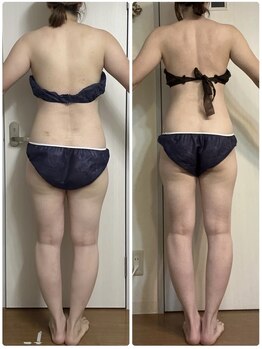 ヨサパーク ベル(YOSA PARK Belle)/回数券20回 3ヶ月