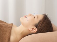 エヌ(N)の雰囲気（電気美容鍼でお顔のむくみ、たるみ予防！美しくすっきりした横顔）