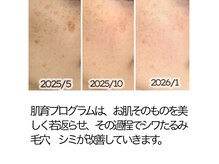 エステティックサロン ラ アクア(ra aqua)の雰囲気（【肌育プログラム】隠す肌からみせる肌へ）