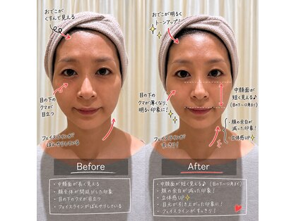 ビラ 銀座店(BILA)の写真