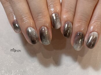 ミニョン(mignon)/mignon定額コース