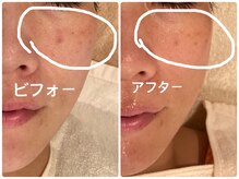 ノーブル シャット Noble Chate/お悩みはタルミだったのですが！