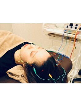 小顔になりたい