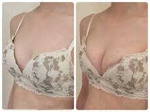 モナンジュ(ramonange)/細身のお客様　before after