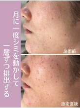 ファン 骨整体 アンド ビューティー ファン 鍼灸(Fan 骨整体&Beauty Fan 鍼灸)/お顔の悩みはコチラで