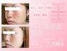〈年々濃くなるシミに終止符を〉-5歳肌？！シミくすみ特化型フェイシャル