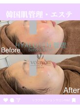 エイチ アンド イー(H&E)/