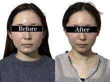 オアシス トウキョウ(Oasis Tokyo)/