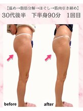 リラ(Lilas)/【痩身】下半身1回目
