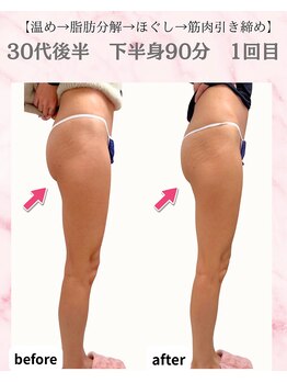 リラ(Lilas)/【痩身】下半身1回目
