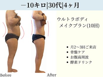 京都フォーエイチ(京都4H)/－10キロ|反り腰改善|4ヶ月|30代