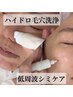 【日時限定】7/18,19,20限定シミケア15分orハイドロ毛穴洗浄¥5000