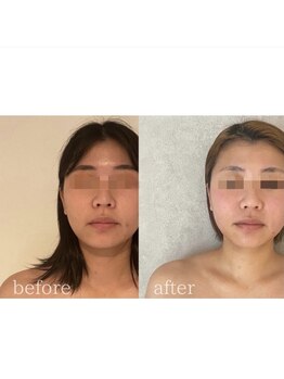 ラズ(Luz)/【小顔60分コース】