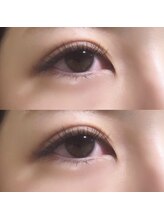 フローレント(Florent)/ラッシュリフト