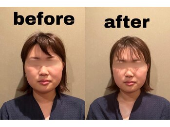 ラースパ アザブ(La SPA azabu)/一回の施術で効果を実感！