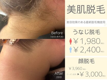 エフイーサンニーイチ(Fe-321)の写真