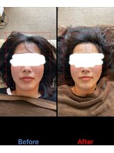 トーラス 整体(TORUS)/顔幅引き締め