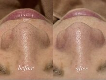 ポアレスラボ ジェンダーレスサロン 横浜/お客様ビフォーアフター