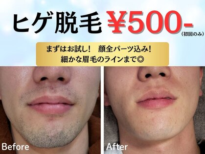 ザ アドア(The Adore)の写真