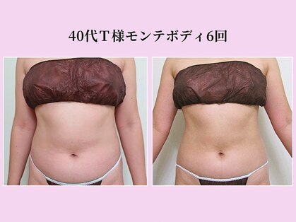 リクラ(Reclat)の写真