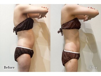 アネル 美里店(anel)/