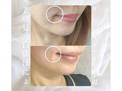 アンド(&.)の写真