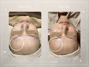 アバンダンティア 姫路店/