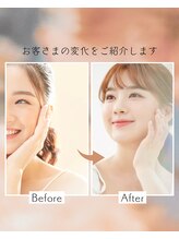 アユーナ(Ayu-Na)&nbsp;ビフォー アフター