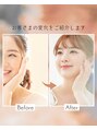 アユーナ(Ayu-Na) ビフォー アフター