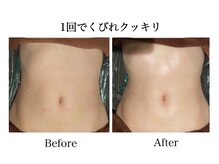 ナチュラーレ 天王寺店(Naturale)/痩身リンパマッサージ二の腕美脚