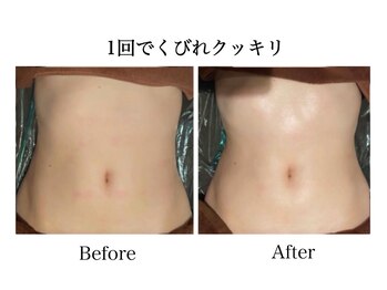 ナチュラーレ 天王寺店(Naturale)/痩身リンパマッサージ二の腕美脚