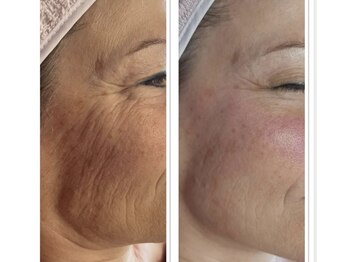 ティーボックスボーテ(TBOX beaute)の写真/【女性専用サロン】完全個室のプライベート空間でリラックスしながら気になるお肌悩みを改善！20時半まで◎