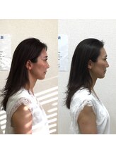 オズ六本木/六本木小顔矯正（造顔）姿勢整う
