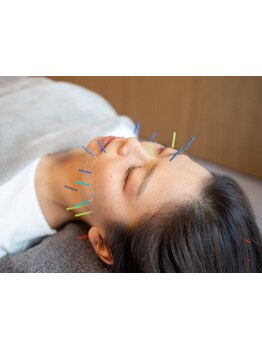 鍼灸施術を受けたい